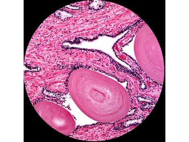 Binocular Compound Microscope M463684